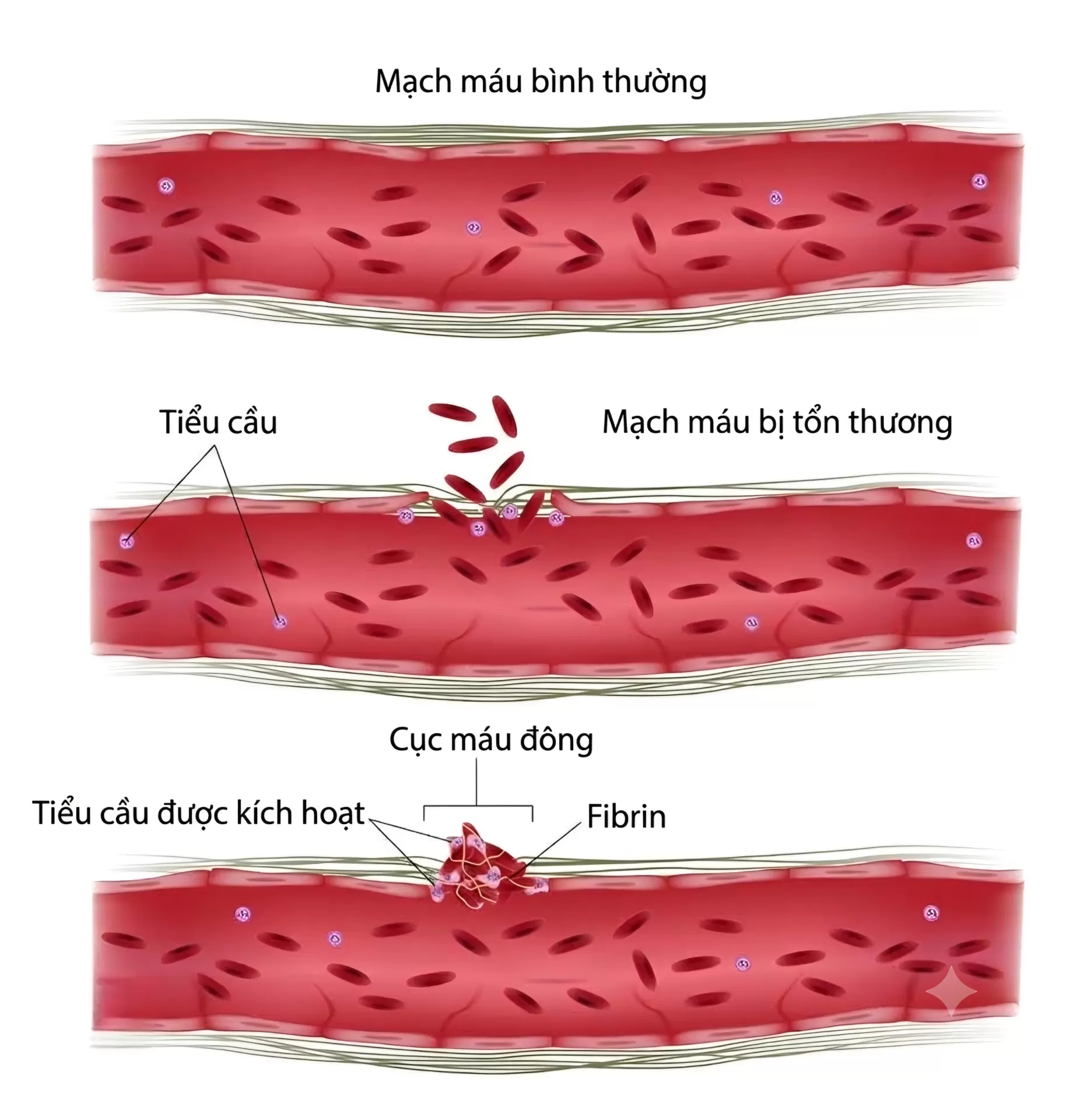 Xét nghiệm thời gian PROTHROMBIN (PT/INR)