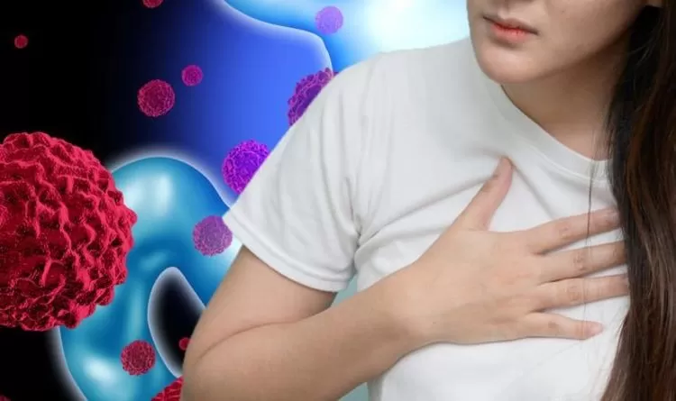 Nấc cụt ở người bệnh ung thư