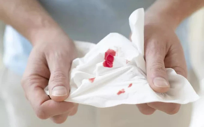 GIẢM TIỂU CẦU KHI ĐIỀU TRỊ UNG THƯ