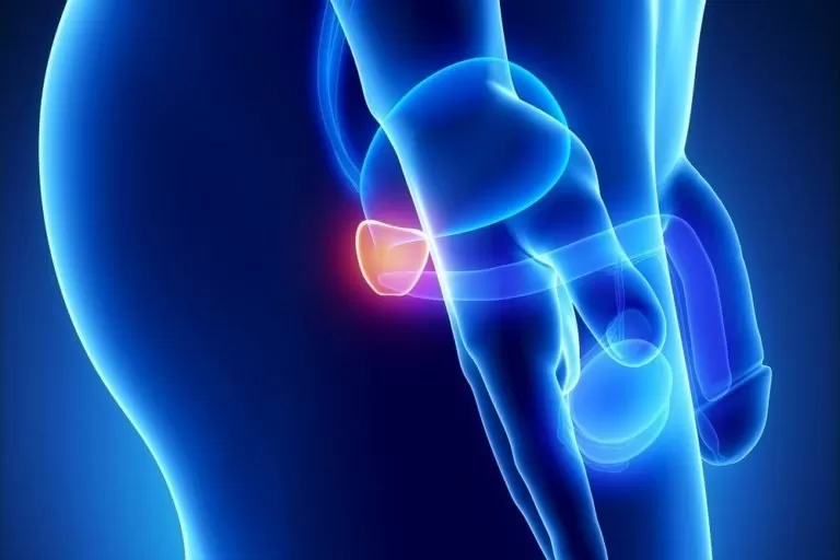 Gói khám sức khỏe định kỳ và phát hiện sớm ung thư tiền liệt tuyến
