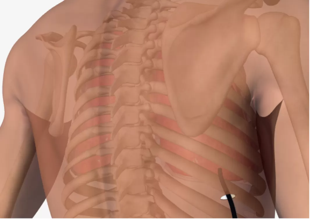 Nội soi lồng ngực