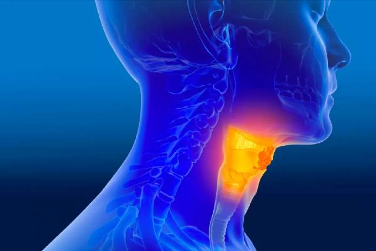 Câu hỏi: Điều trị ung thư đầu cổ có thể khỏi không?