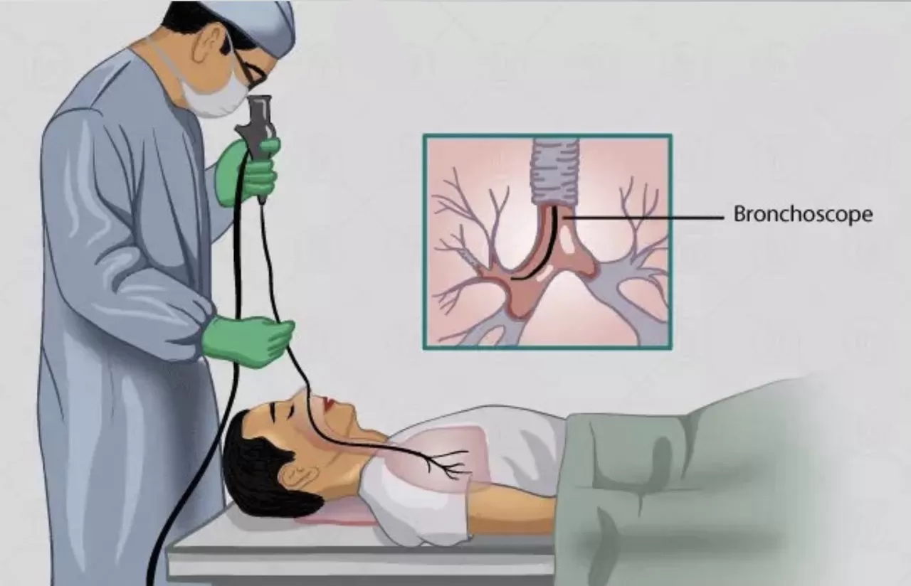 Câu hỏi: Khi nào cần nội soi phế quản để chẩn đoán ung thư phổi?