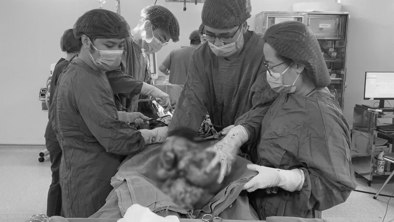 Phẫu thuật khối u sarcoma tử cung nặng gần 9kg