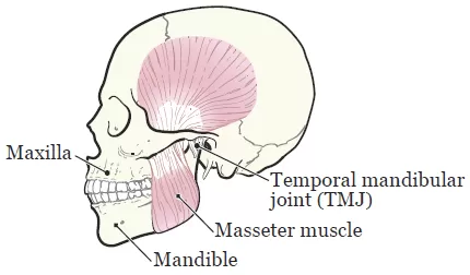 Quản lý khít hàm sau điều trị ung thư đầu cổ
