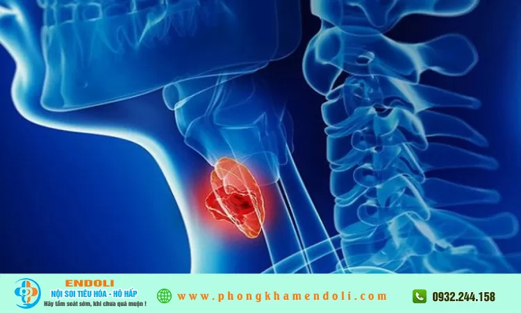 Câu hỏi: Khàn tiếng bao lâu thì cần đi khám?