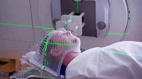Câu hỏi: Xạ trị ung thư đầu cổ có đáng sợ không?