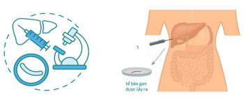 CÁC PHƯƠNG PHÁP CHẨN ĐOÁN UNG THƯ BIỂU MÔ TẾ BÀO GAN