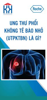 UNG THƯ PHỔI KHÔNG TẾ BÀO NHỎ