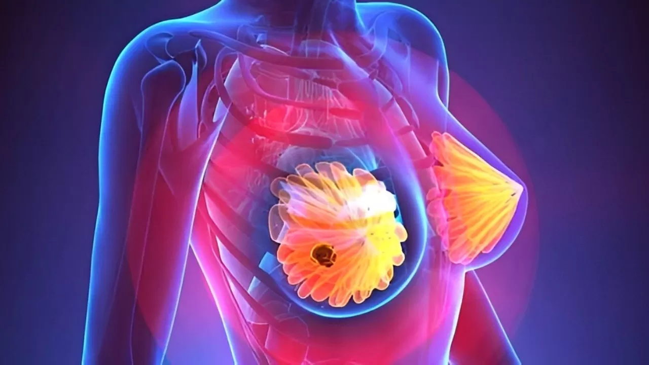 Gói khám sức khỏe định kỳ và phát hiện sớm ung thư vú - cổ tử cung - tử cung - buồng trứng